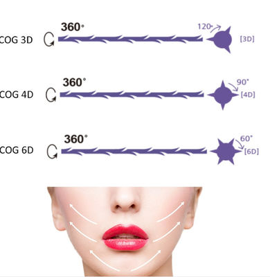 Le serrage médical de soins de la peau d'ascenseur de fil de nez de PDO Pcl filète le traitement de peau