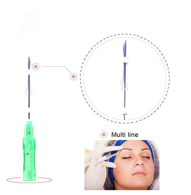 ascenseur facial de moulage de fil de collagène de corps d'ascenseur de fil de 29g 30g 25mm PDO
