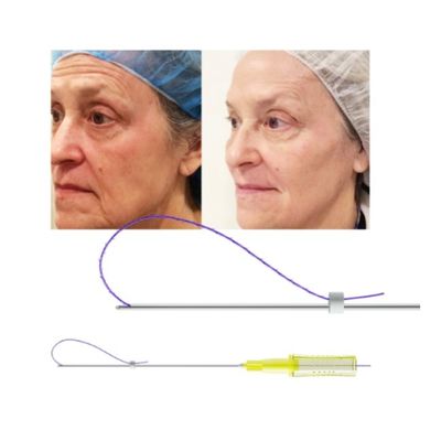 vis mono de tornade de remontée du visage d'injection de fil de nez d'ascenseur de fil de 3D 4D 6D PDO