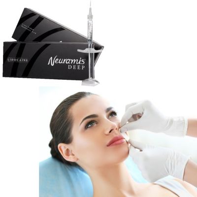 1 ml de remplissage cutané Neuramis pour le traitement de surface à profondeur sur le visage