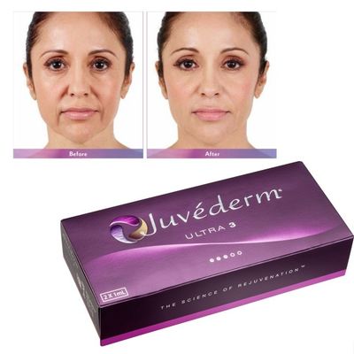 Acide hyaluronique Juvederm Gel de remplissage du visage Peau lisse et sans défaut