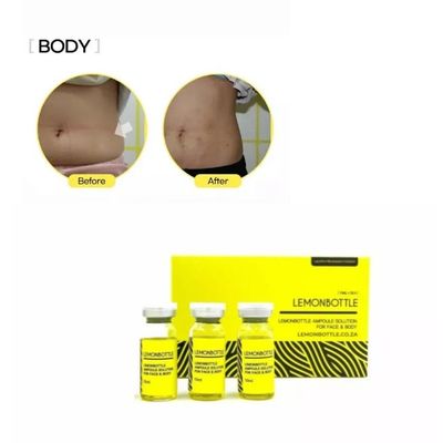 Vente bouteille de citron Dissolveur de graisse 5X10ml Boîte de perte de poids Solution en ligne