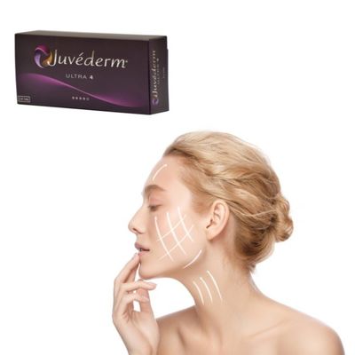 Gel de remplissage cutané à l' acide hyaluronique pour le remplissage des rides - Juvederm Solution