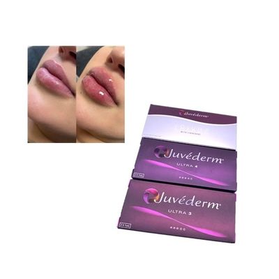 Injection Juvederm Voluma Remplisseur cutané croisé