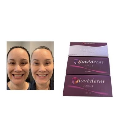 HA Juvederm, remplisseur cutané Ultra3 Ultra4 Volume, relié croisé Conditions de stockage Évitez de congeler Gel injectable pour le volume du visage