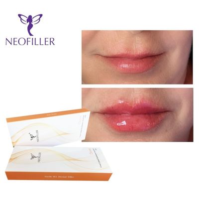 1 ml de gel injectable de remplissage cutané à l' acide hyaluronique 9 à 12 mois Rajeunissement naturel Amélioration du visage