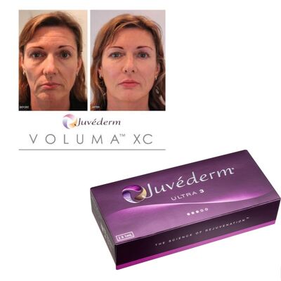 Juvederm Filler Dermique Gel injectable avec acide hyaluronique pendant 6 à 9 mois Durée et stockage à température ambiante