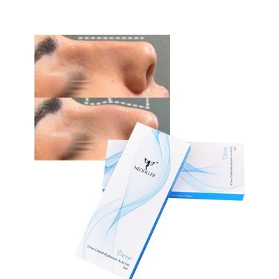 Remplisseur cutané à l'acide hyaluronique réticulé de 2ml, ligne profonde, Contour du nez, Gel injectable, amélioration du visage