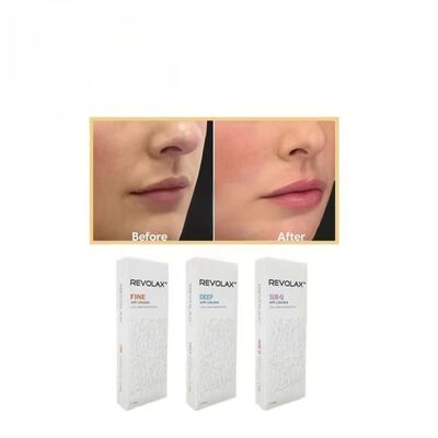 L' acide hyaluronique Revolax est un produit de remplissage cutané injectable sub-Q fin et profond pour le volume des lèvres.