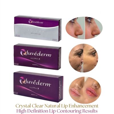 Volume de la seringue 2 1 ml par boîte Juvederm Volume Filler Sécurité Contouring du visage Filler cutané injectable pour augmentation du volume
