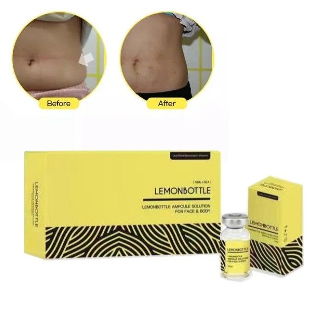 Solution en bouteille de citron à haute concentration pour injections de dissolution des graisses 5 flacons X 10 ml Corps entier