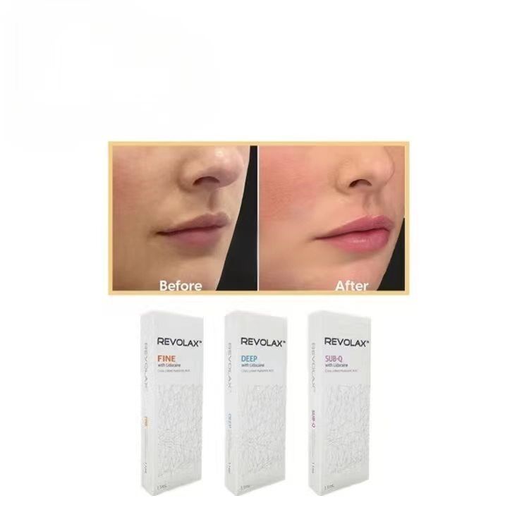 Le remplisseur cutané Revolax sub-Q profond et fin Oui Concentration de Ha 24 mg Gel injectable pour le contour et le volume du visage